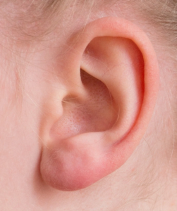Minimizing Your Chances of Hearing Loss