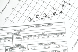 When is Hearing Loss a Disability? 