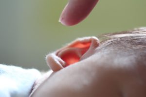 congenital hearing loss bay area audiology